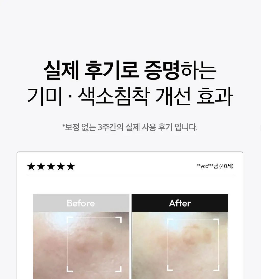 [기미잡티세럼] 레이어랩 기미흔적 클리어 세럼 30ml 상세페이지 30